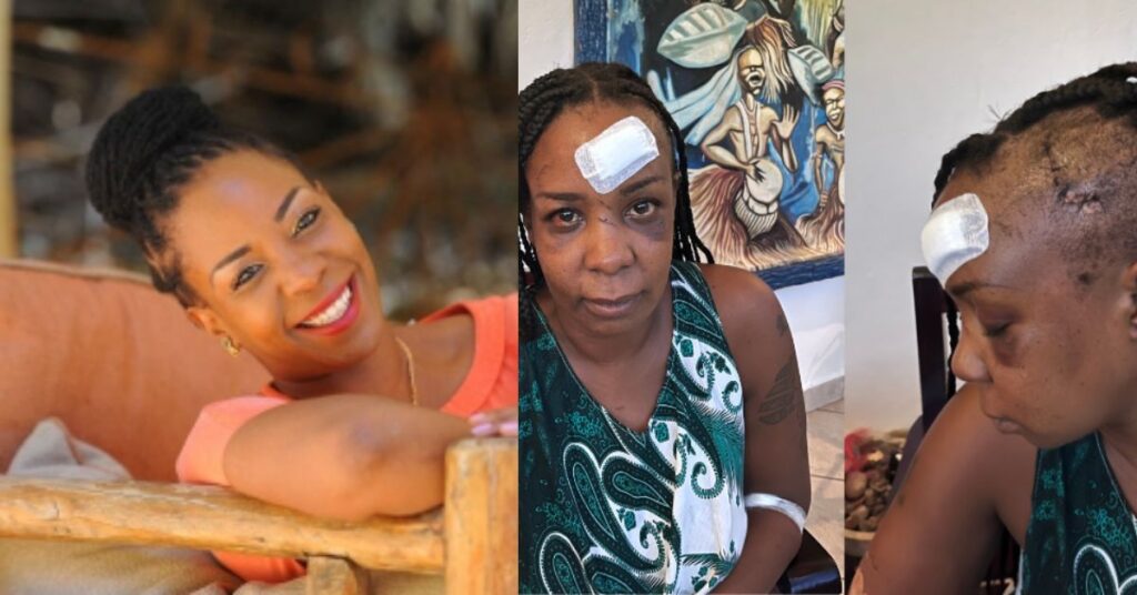 Mumbi Seraki: Online Activist Returns with Injuries After Mysterious Disappearance