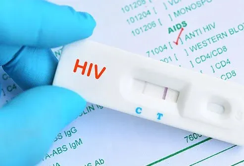Kenya Achieves Nearly 80% Drop in New HIV Infections, UNAIDS Reports